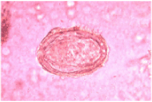 File:Schistosoma japonicum.gif